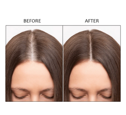 Follicra™ Infrared Hair Growth Kit
