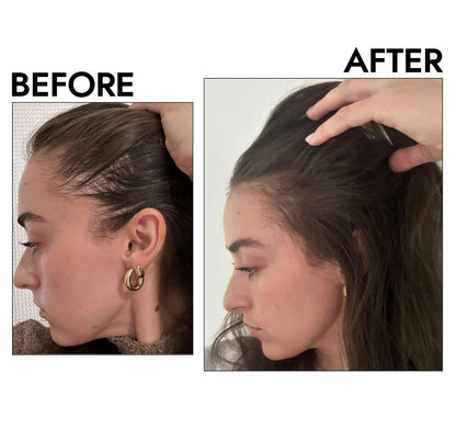 Follicra™ Infrared Hair Growth Kit